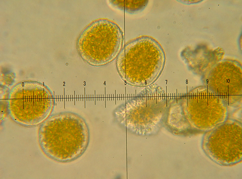 Puccinia 3 su Frangula alnus